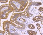 Aquaporin 1 Antibody in Immunohistochemistry (Paraffin) (IHC (P))