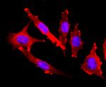 FGFR3 Antibody in Immunocytochemistry (ICC/IF)