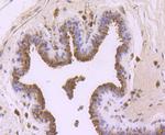 FGFR3 Antibody in Immunohistochemistry (Paraffin) (IHC (P))