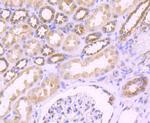 FGFR3 Antibody in Immunohistochemistry (Paraffin) (IHC (P))