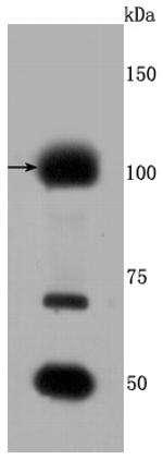 FGFR3 Antibody in Western Blot (WB)