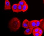 Perilipin 1 Antibody in Immunocytochemistry (ICC/IF)