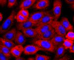 Perilipin 1 Antibody in Immunocytochemistry (ICC/IF)