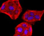 Perilipin 1 Antibody in Immunocytochemistry (ICC/IF)