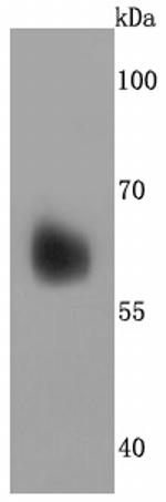 Perilipin 1 Antibody in Western Blot (WB)