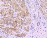 SDHA Antibody in Immunohistochemistry (Paraffin) (IHC (P))