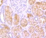 SDHA Antibody in Immunohistochemistry (Paraffin) (IHC (P))