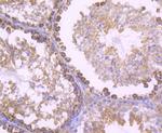 SDHA Antibody in Immunohistochemistry (Paraffin) (IHC (P))