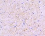 SDHA Antibody in Immunohistochemistry (Paraffin) (IHC (P))