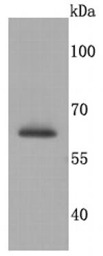 SDHA Antibody in Western Blot (WB)