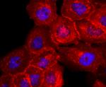 CD138 Antibody in Immunocytochemistry (ICC/IF)