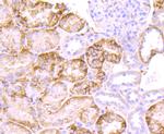 CD138 Antibody in Immunohistochemistry (Paraffin) (IHC (P))