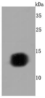 Hemoglobin gamma-1,2 Antibody in Western Blot (WB)