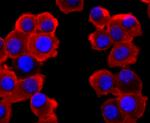 VAMP2 Antibody in Immunocytochemistry (ICC/IF)