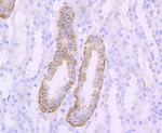 CD171 (L1CAM) Antibody in Immunohistochemistry (Paraffin) (IHC (P))