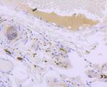 CD171 (L1CAM) Antibody in Immunohistochemistry (Paraffin) (IHC (P))