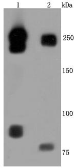 CD171 (L1CAM) Antibody in Western Blot (WB)