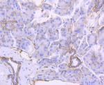 CD104 (Integrin beta 4) Antibody in Immunohistochemistry (Paraffin) (IHC (P))