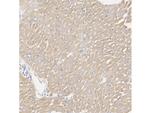 ATP5A1 Antibody in Immunohistochemistry (Paraffin) (IHC (P))