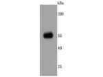 CaMKII alpha Antibody in Western Blot (WB)