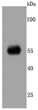 CaMKII alpha Antibody in Western Blot (WB)