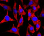 NEFM Antibody in Immunocytochemistry (ICC/IF)