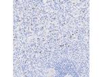 TIA-1 Antibody in Immunohistochemistry (Paraffin) (IHC (P))