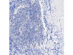 TIA-1 Antibody in Immunohistochemistry (Paraffin) (IHC (P))