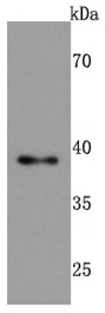 TIA-1 Antibody in Western Blot (WB)