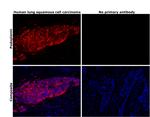 Podoplanin Antibody in Immunohistochemistry (Paraffin) (IHC (P))