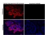 Podoplanin Antibody in Immunohistochemistry (Paraffin) (IHC (P))