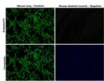 Podoplanin Antibody in Immunohistochemistry (Paraffin) (IHC (P))