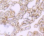 Podoplanin Antibody in Immunohistochemistry (Paraffin) (IHC (P))