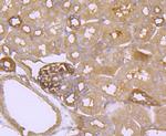 FGFR3 Antibody in Immunohistochemistry (Paraffin) (IHC (P))