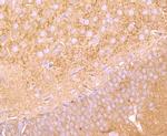 FGFR3 Antibody in Immunohistochemistry (Paraffin) (IHC (P))