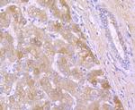 A2M Antibody in Immunohistochemistry (Paraffin) (IHC (P))