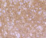 S100 Antibody in Immunohistochemistry (Paraffin) (IHC (P))