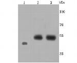 Endothelin B Receptor Antibody in Western Blot (WB)