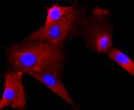 RAC1/RAC2/RAC3 Antibody in Immunocytochemistry (ICC/IF)