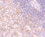 RAC1/RAC2/RAC3 Antibody in Immunohistochemistry (Paraffin) (IHC (P))