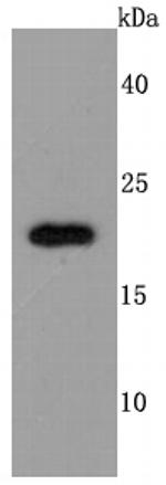 TIMP2 Antibody in Western Blot (WB)