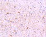 mGluR1 Antibody in Immunohistochemistry (Paraffin) (IHC (P))