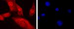 CTCF Antibody in Immunocytochemistry (ICC/IF)