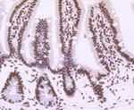 CTCF Antibody in Immunohistochemistry (Paraffin) (IHC (P))