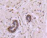 CTCF Antibody in Immunohistochemistry (Paraffin) (IHC (P))