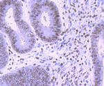 CTCF Antibody in Immunohistochemistry (Paraffin) (IHC (P))