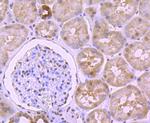 CTCF Antibody in Immunohistochemistry (Paraffin) (IHC (P))