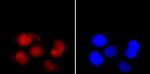 Ku70 Antibody in Immunocytochemistry (ICC/IF)