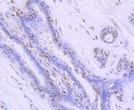 Ku70 Antibody in Immunohistochemistry (Paraffin) (IHC (P))