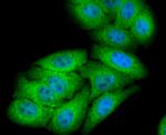 NUR77 Antibody in Immunocytochemistry (ICC/IF)